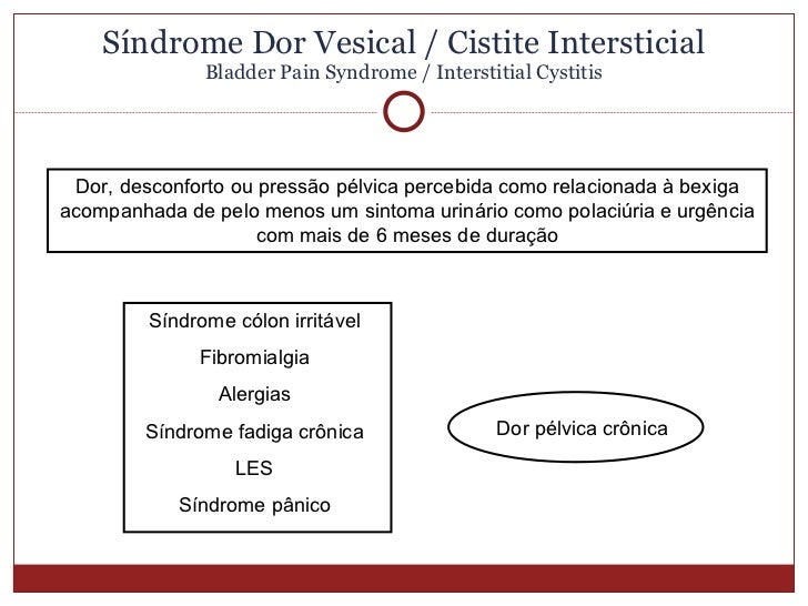 cistite intersticial